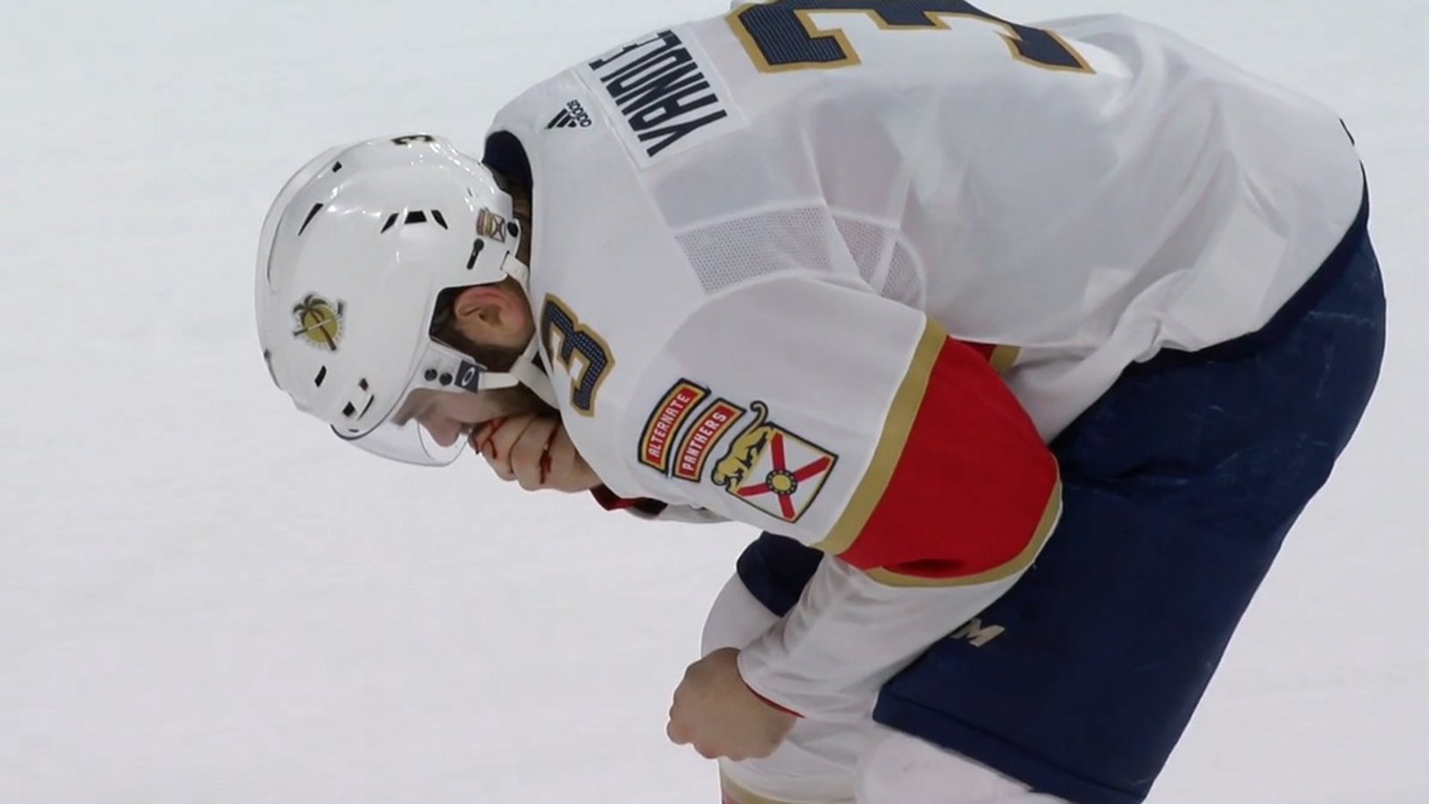 Keith Yandle loses 9 teeth in the blink of an eye.