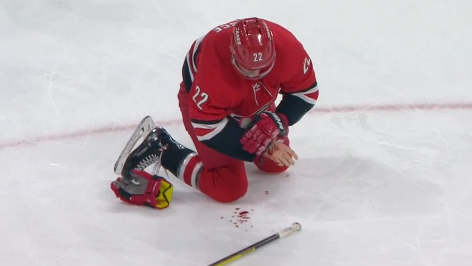 Brett Pesce left bleeding all over the ice after blocking a shot.