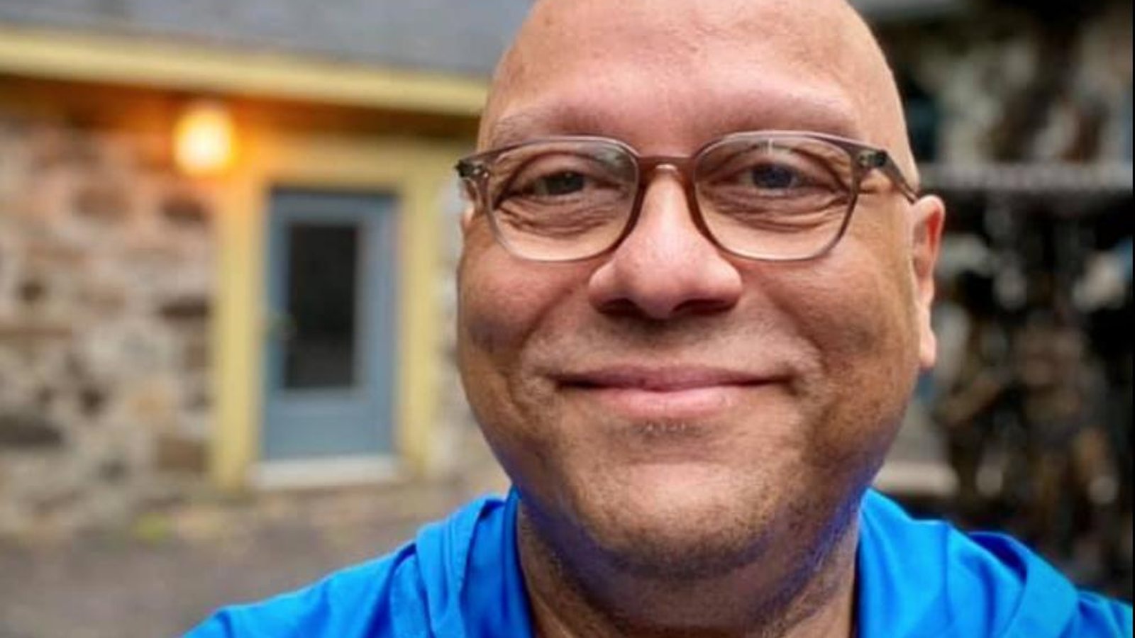 Josélito Michaud explique comment il a perdu tous ses cheveux d'un seul coup