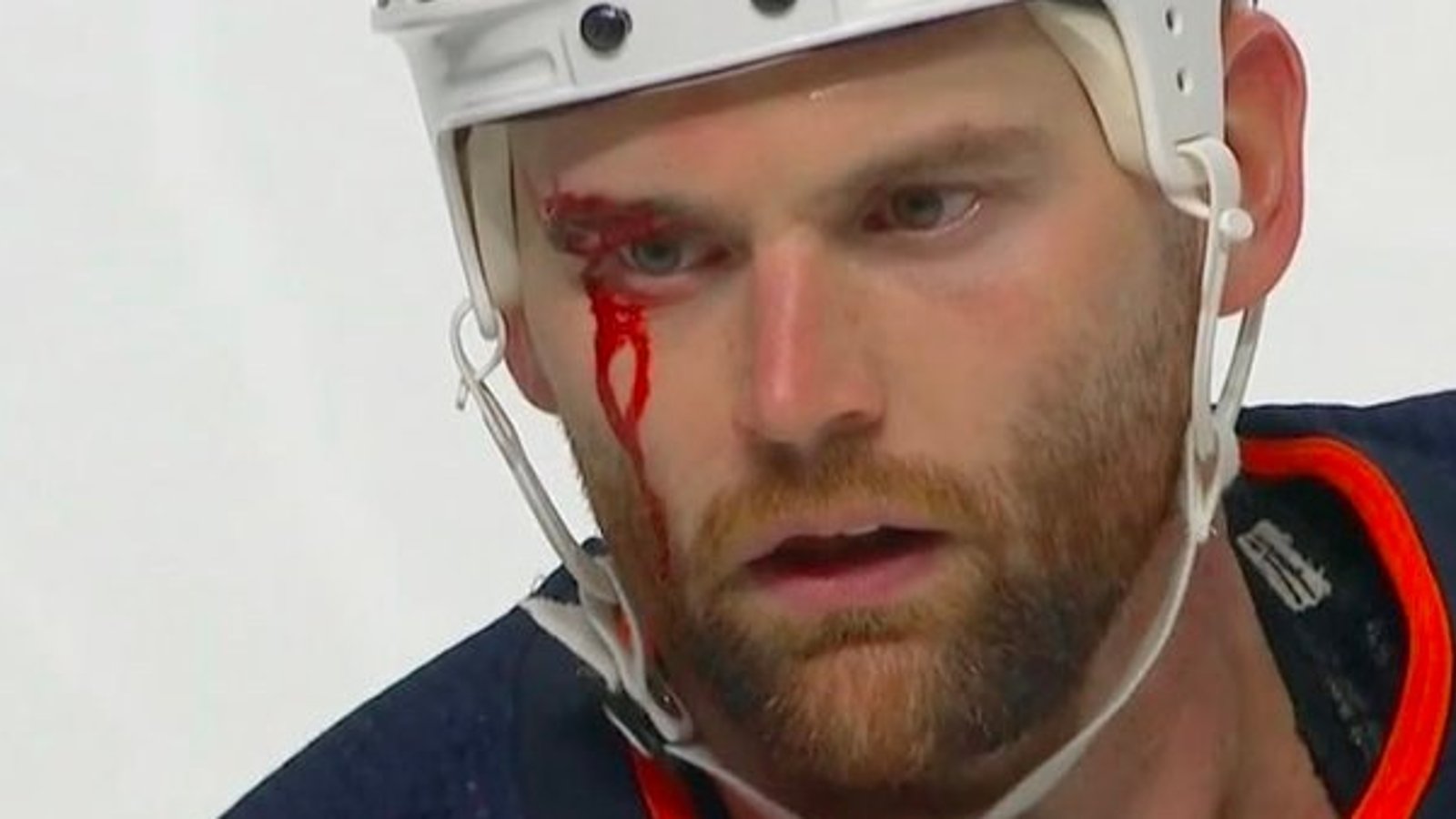 VIDÉO | Michael Pezzetta engage le combat contre Zack Kassian suite à son coup sur Montembeault