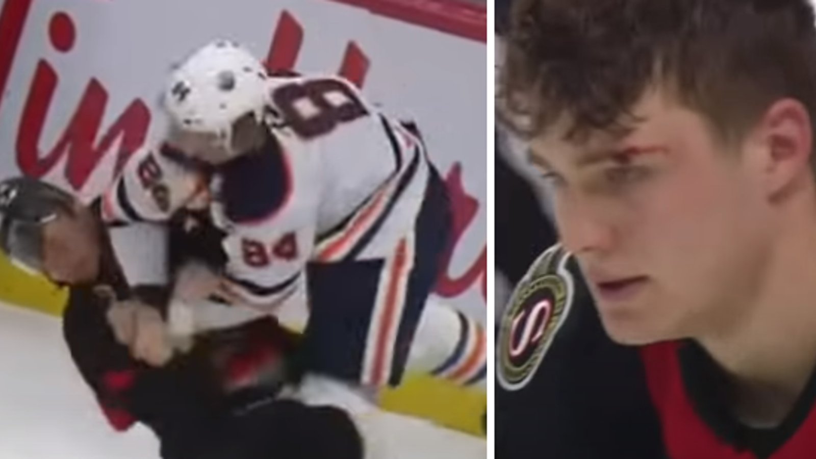 VIDÉO | Tim Stützle reçoit un violent coup au visage lors de son premier combat dans la LNH