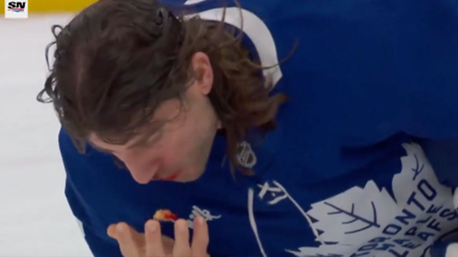 Chris Tanev blocks a shot with his face, spits out mouthful of teeth!