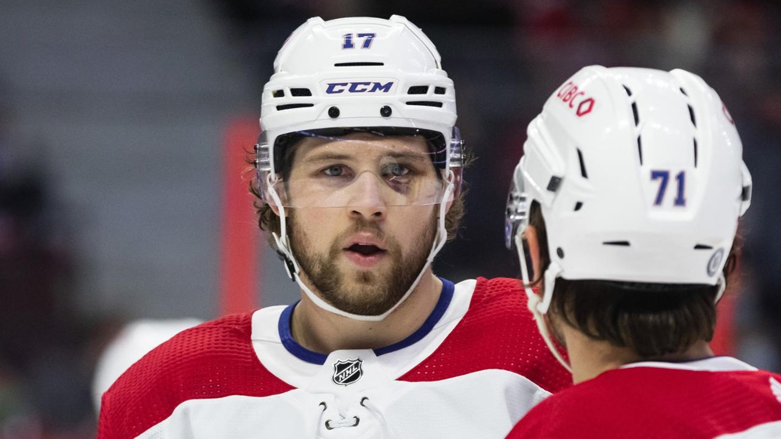 Insider spills the beans on Josh Anderson’s weird upper-body injury
