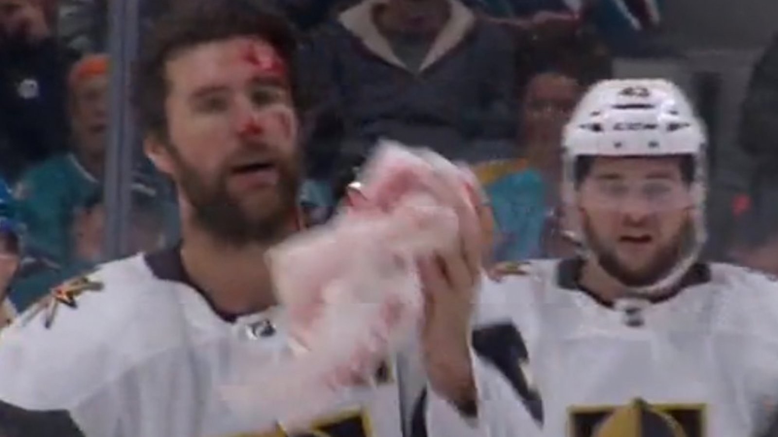 Bloody scene as Alex Pietrangelo takes 90 mph shot to the head!