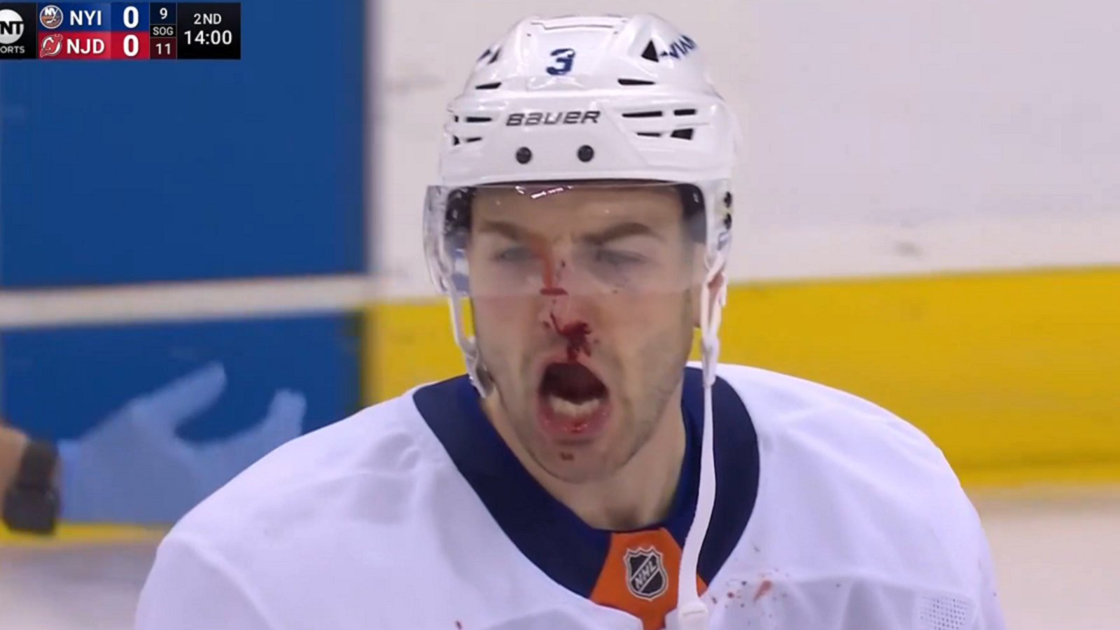Paul Cotter facing suspension for hit on Adam Pelech.