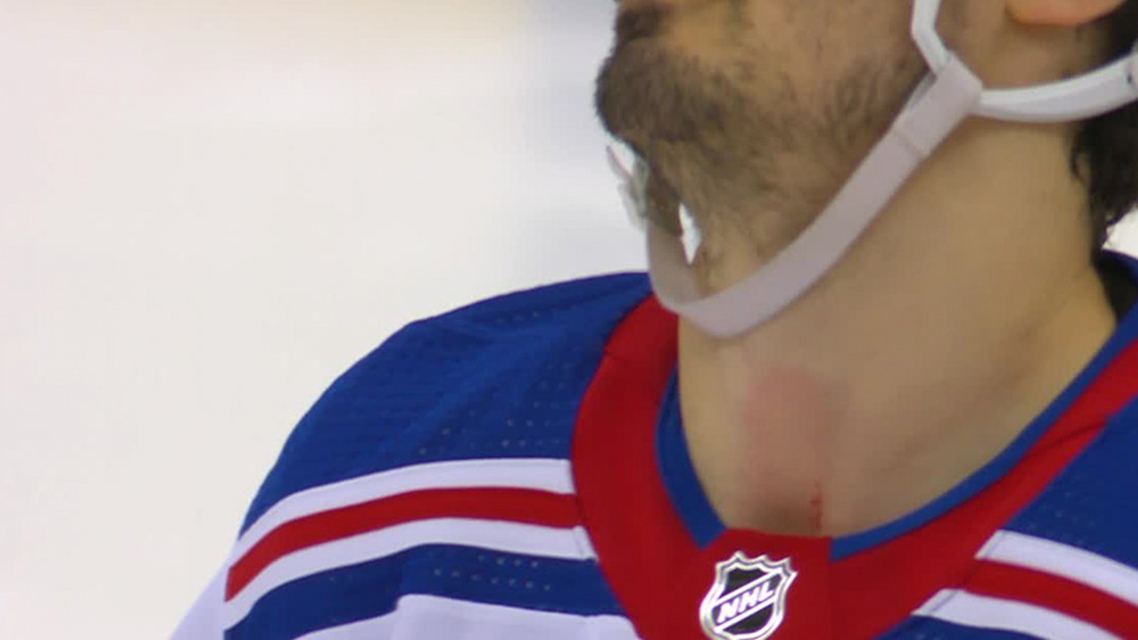 MUST SEE: Rangers F Chris Kreider narrowly avoids horrifying injury