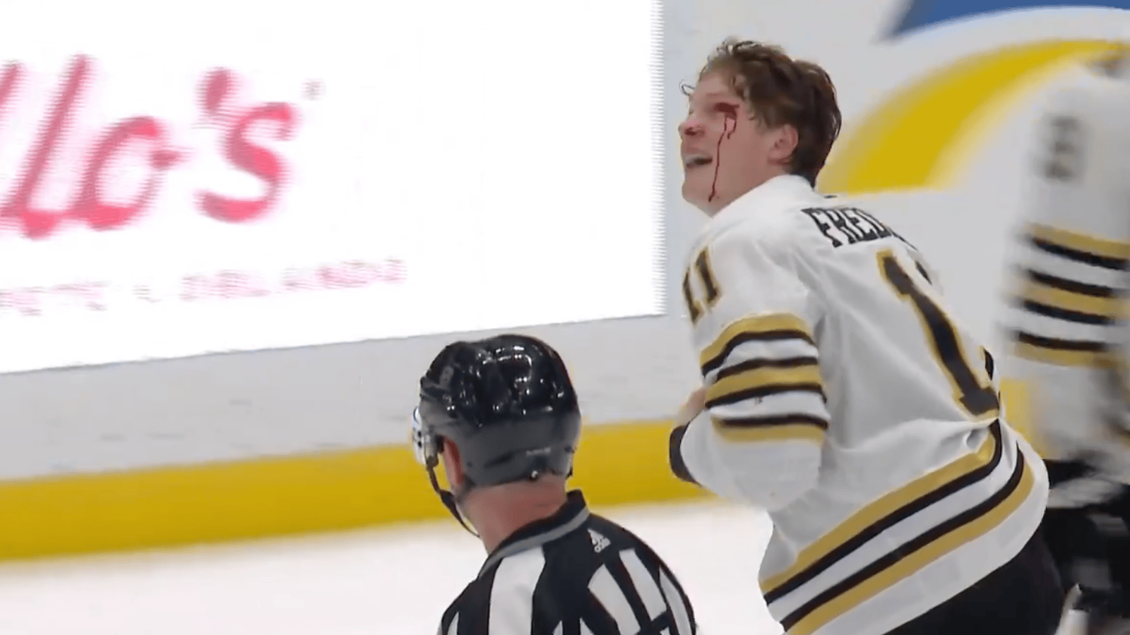 Trent Frederic bloodied after intense fight with Tanner Jeannot 