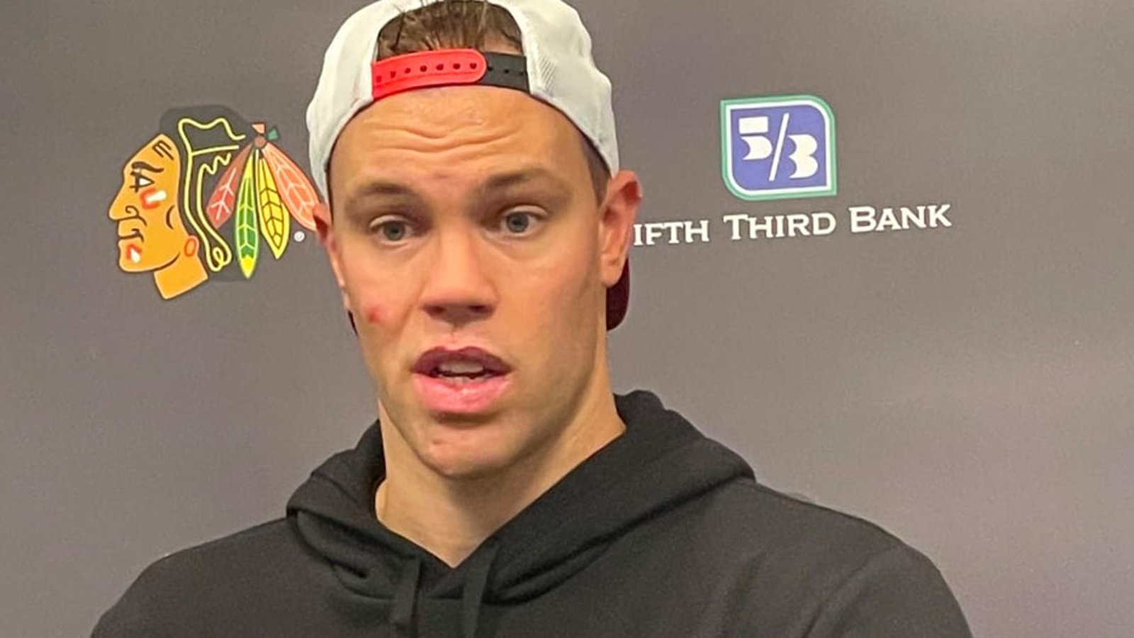 Is Taylor Hall done?