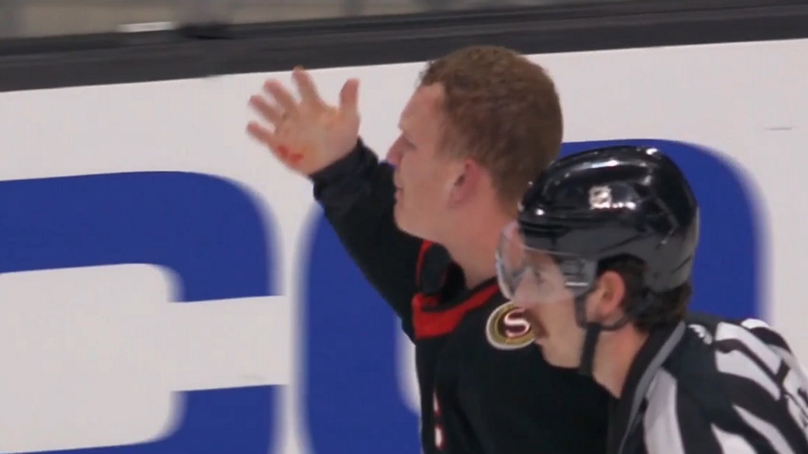 Brendan Lemieux facing a huge suspension for biting Brady Tkachuk.