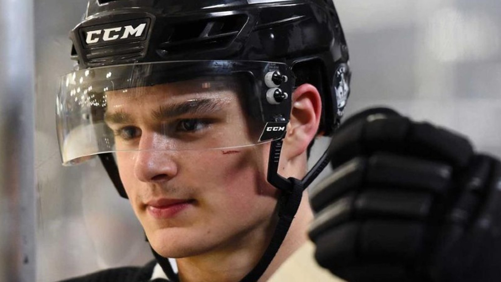 The worst is confirmed for Kings’ Alex Turcotte