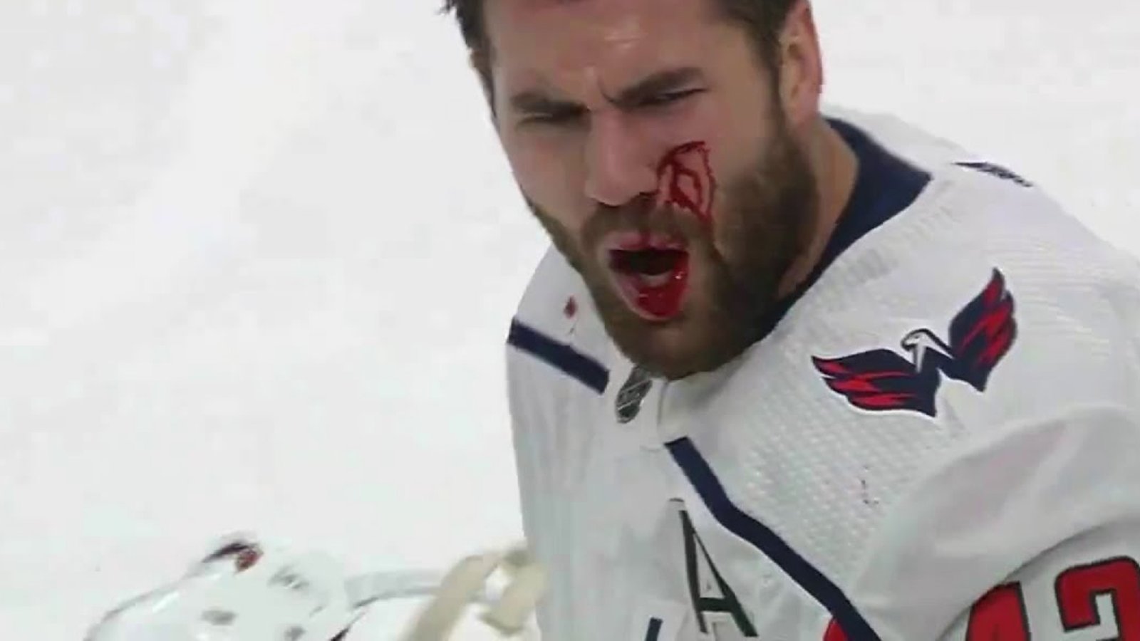 Tom Wilson still blowing blood out of his nose ahead of tomorrow’s game