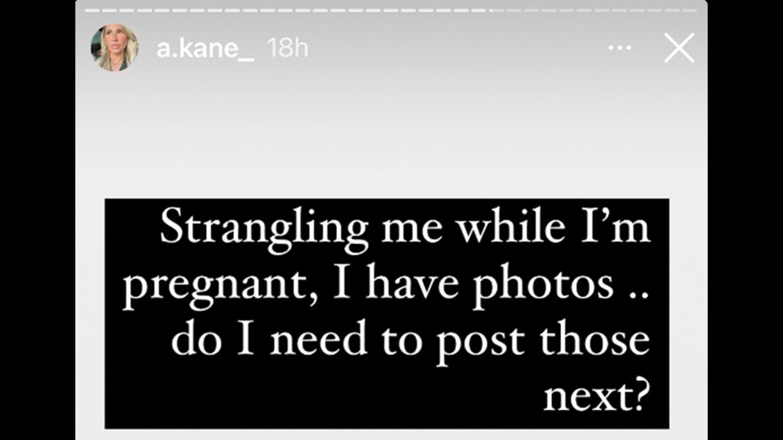 Evander Kane's ex-wife posts disturbing photos, accuses him of strangling her while she was pregnant