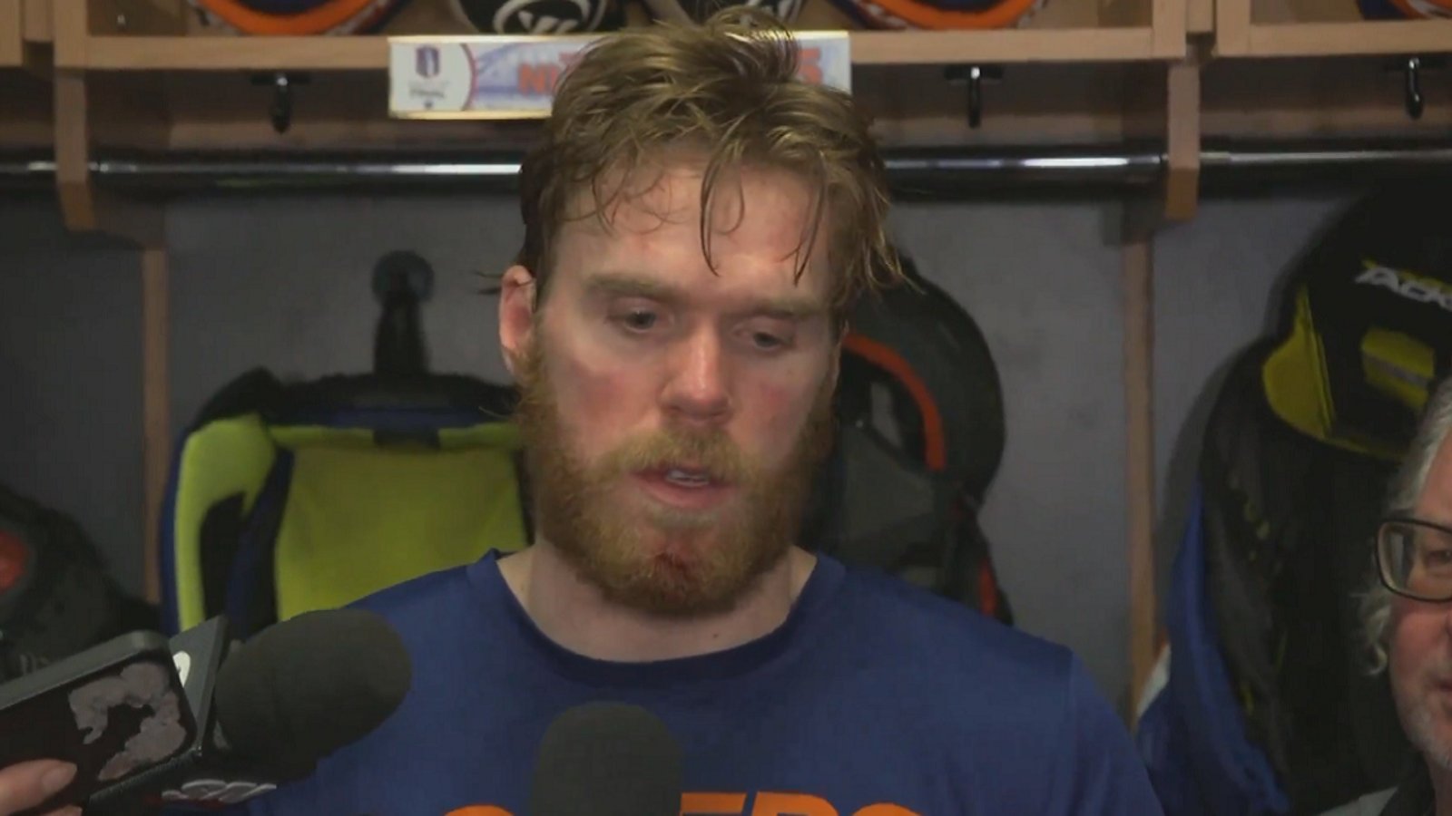 McDavid gives unbelievable excuse for loss in Game 1.