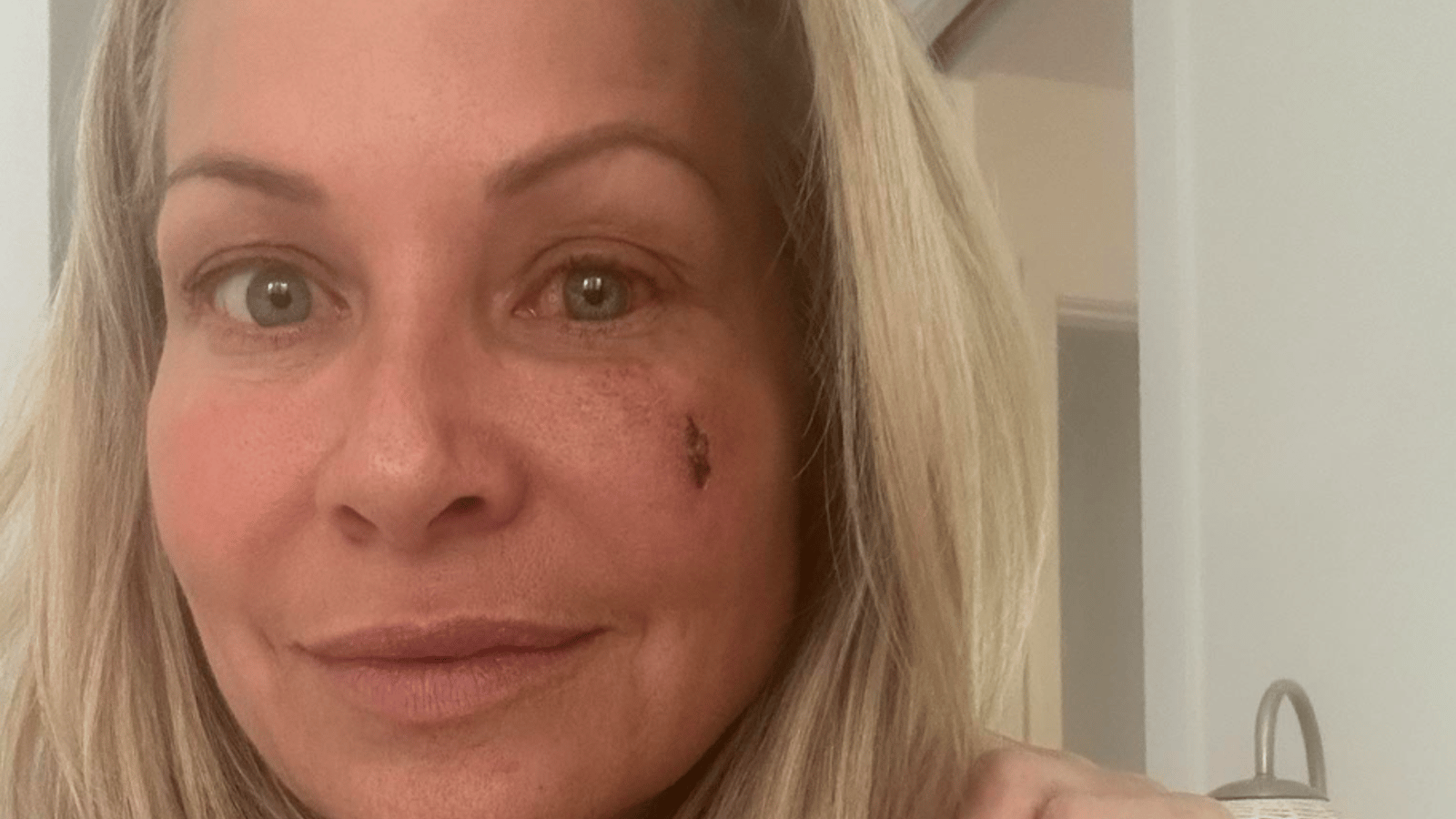 Katherine Huet atteinte de graves séquelles après sa blessure à survivor québec