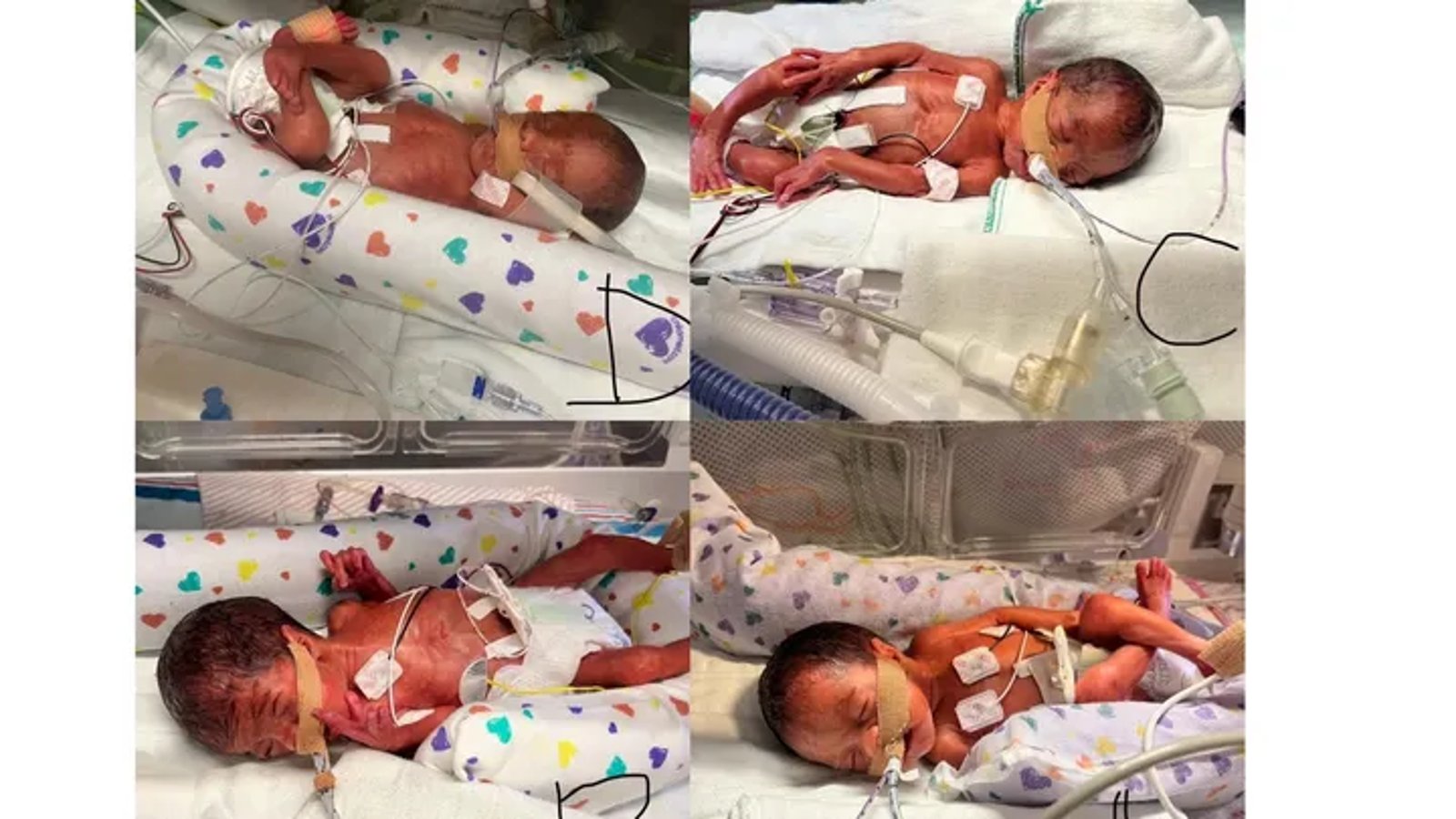 Une famille de la Saskatchewan accueille des quadruplés le 29 février.