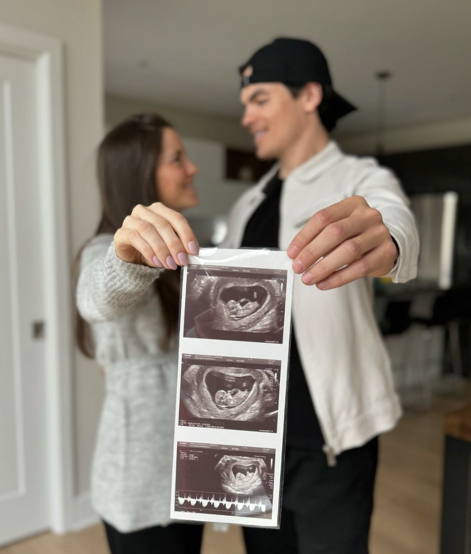 Mikaël Kingsbury annonce que son amoureuse est enceinte de leur premier enfant