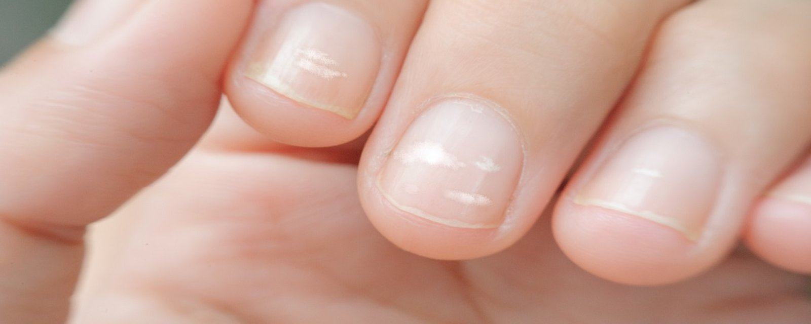 Vos ongles cassent ou dédoublent constamment? Voici ce que votre corps essaie de vous dire! 