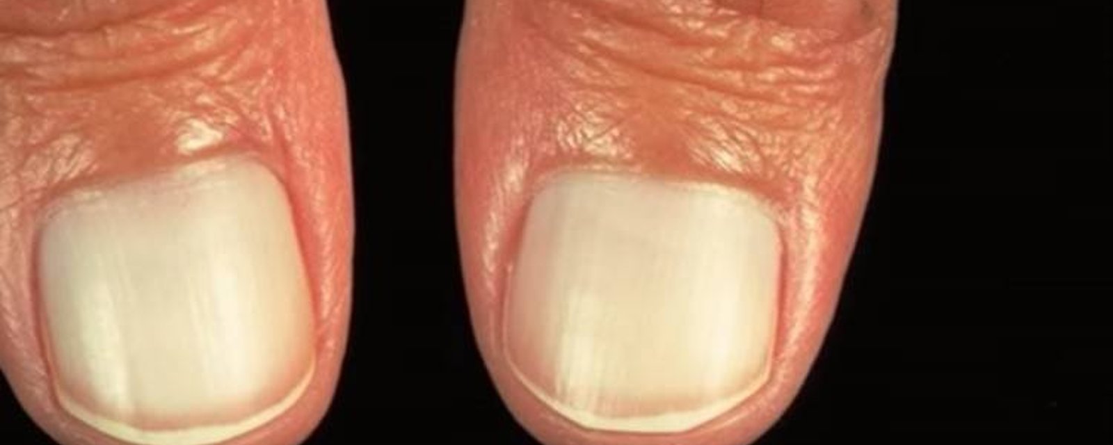 7 problèmes sur vos ongles sur lesquels vous devriez vous attarder