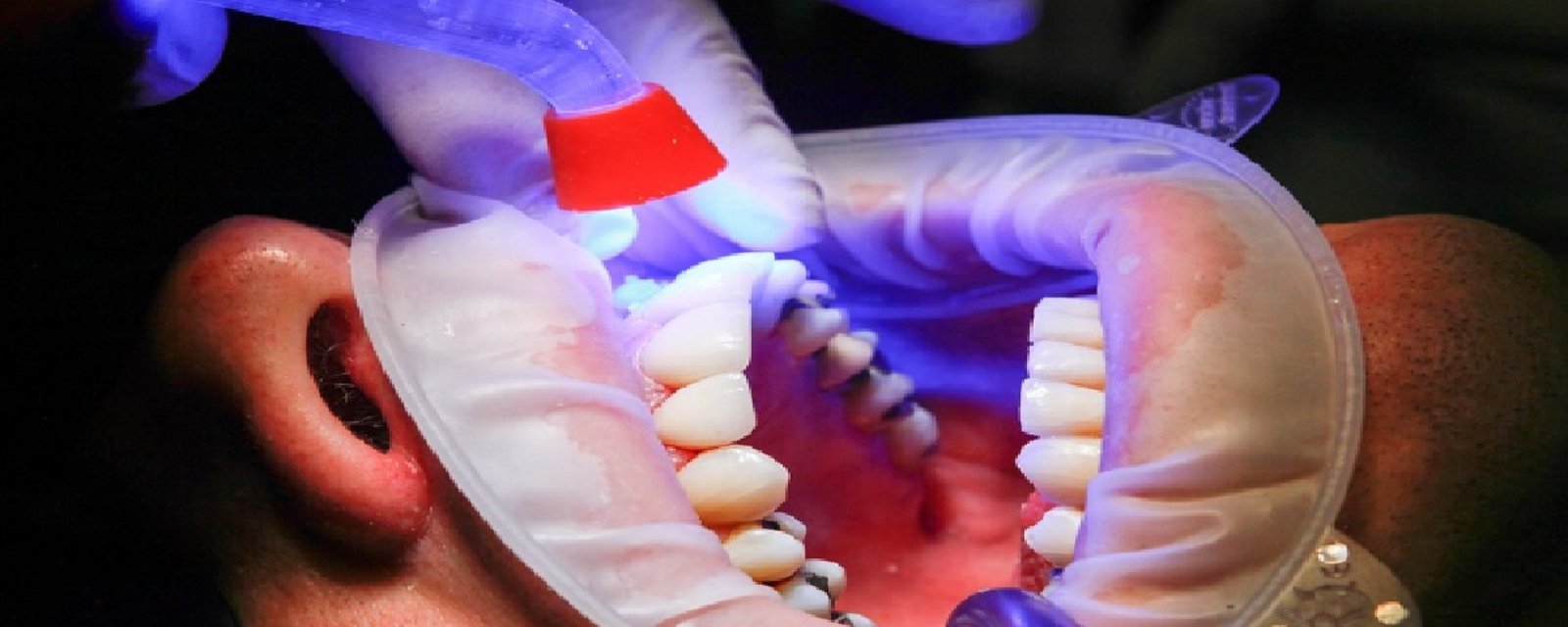 Les dentistes ne veulent pas vous révéler ce secret : Incorporez ces 3 ingrédients à votre dentifrice pour des belles dents blanches
