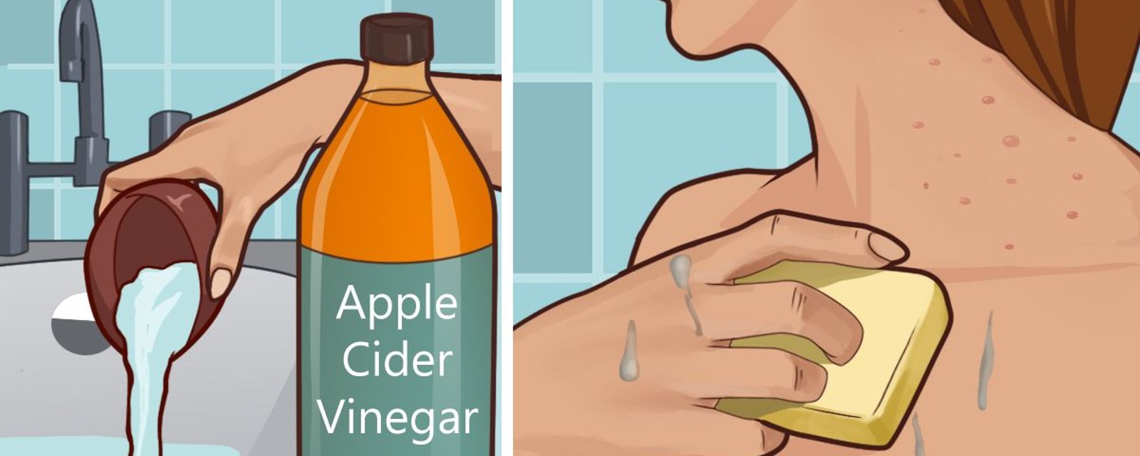 Appliquez du vinaigre de cidre de pomme sur votre visage et voyez ce qui arrive à vos taches de vieillesse, votre acné et autre...! 