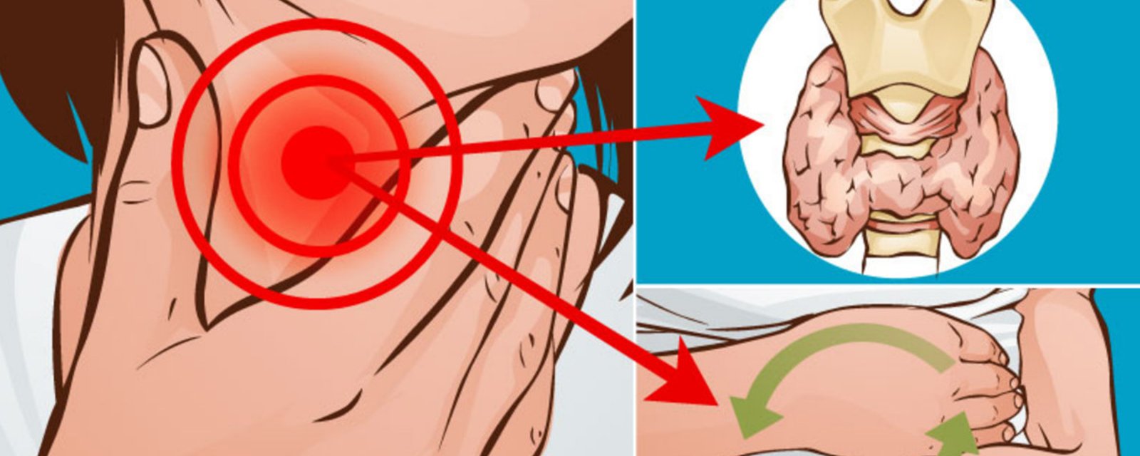 10 signes, dont la prise de poids, qui peuvent indiquer que vous avez un problème de glande thyroïde!