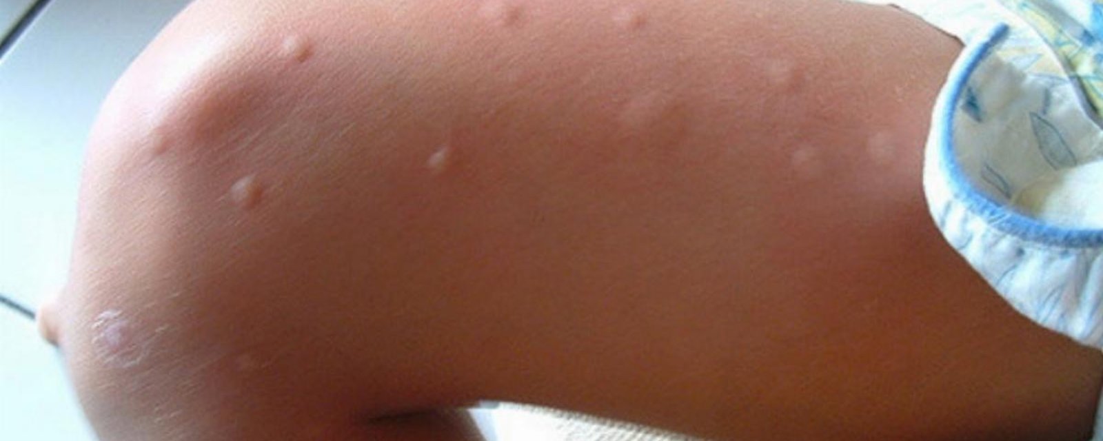 Je me suis toujours demandé pourquoi les moustiques me piquaient toujours plus que les autres! Maintenant je sais! 
