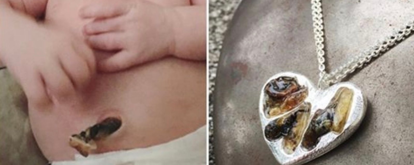 Des parents conservent le cordon ombilical de leur bébé pour en faire des bijoux