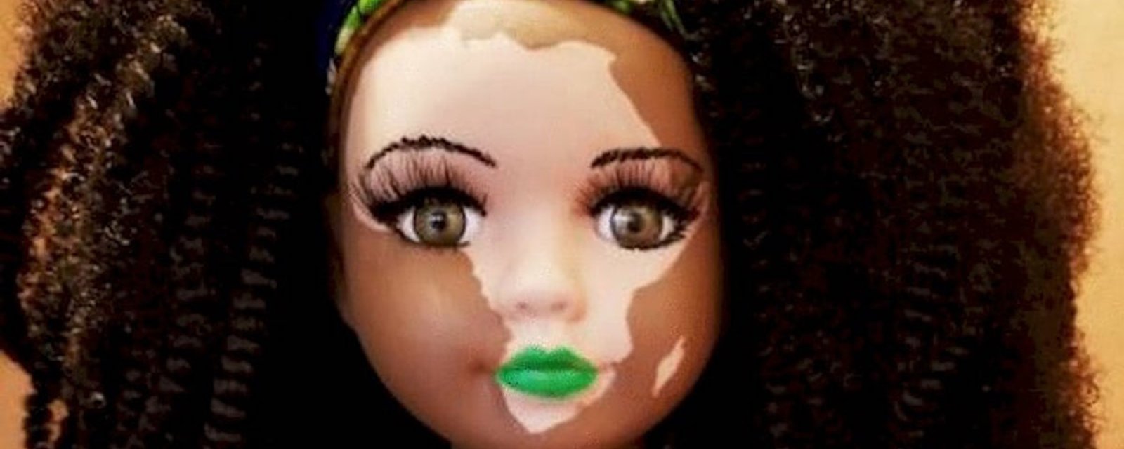 Une femme crée des poupées étonnantes pour aider les enfants atteints de vitiligo