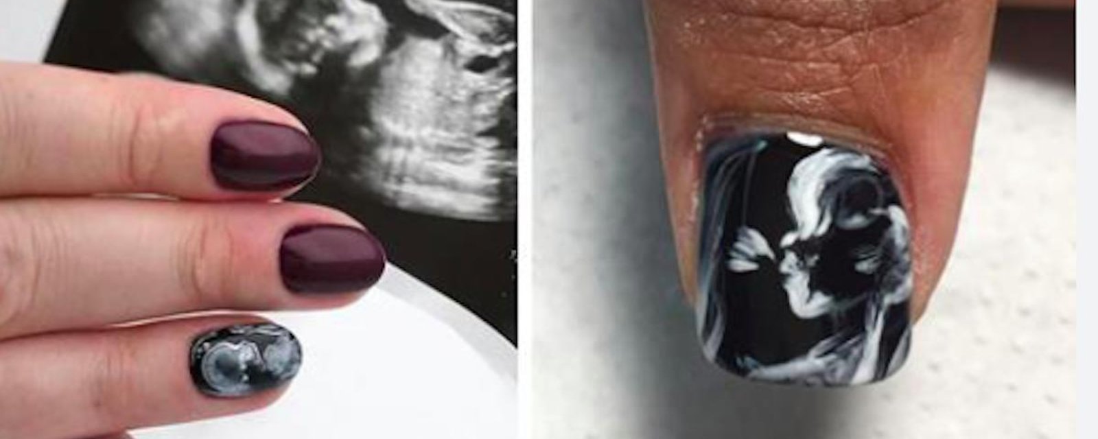 Nouvelle tendance chez les femmes enceintes: les ongles qui exposent leurs échographies!