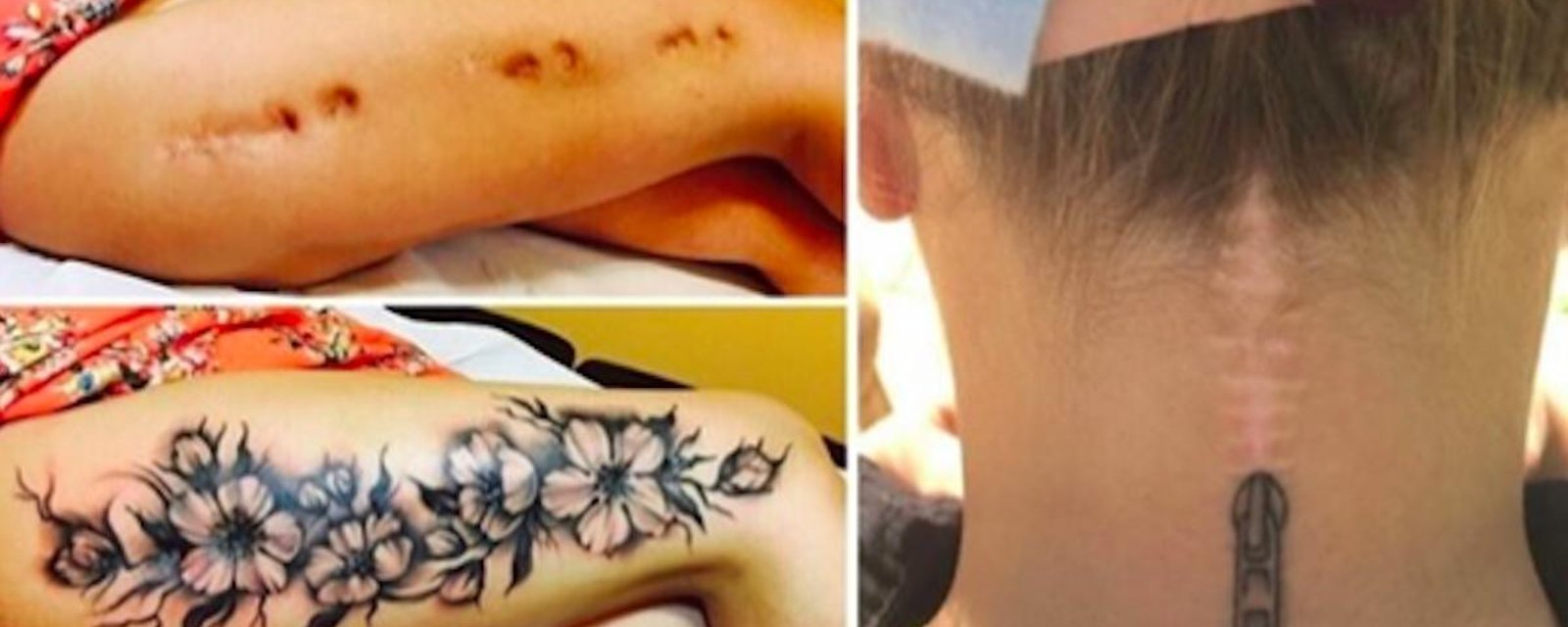 Des tatoueurs transforment des cicatrices en de véritables oeuvres d’art