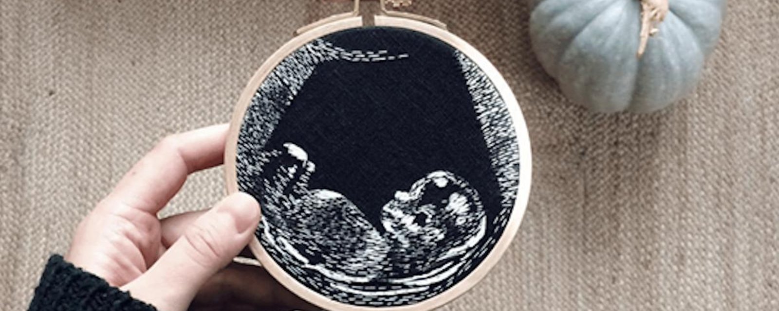 15 façons originales de conserver le souvenir d’une échographie de grossesse