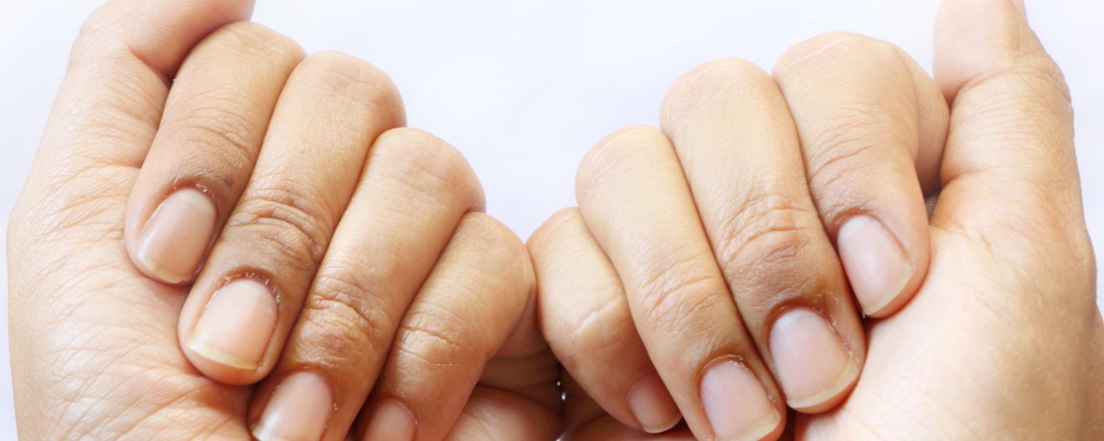 7 signes à surveiller sur vos ongles