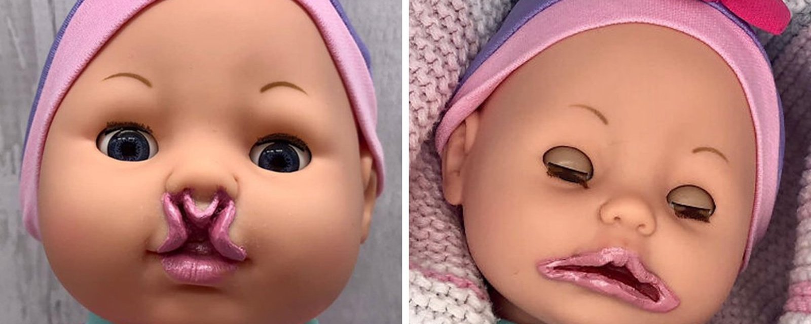 Une maman s’est mise à fabriquer des poupées inclusives car elle n’en trouvait pas pour sa propre fille