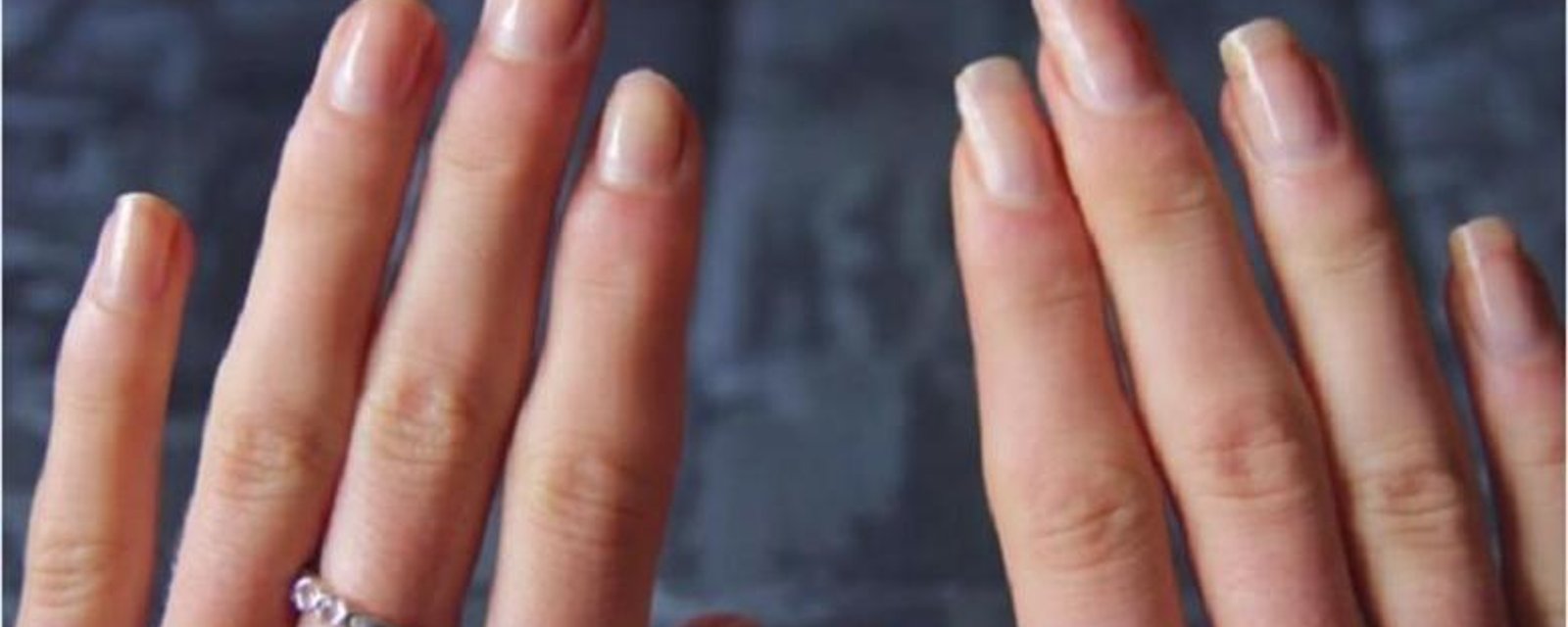 Recette extrême pour la croissance des ongles! Faites allonger vos ongles plus rapidement! 