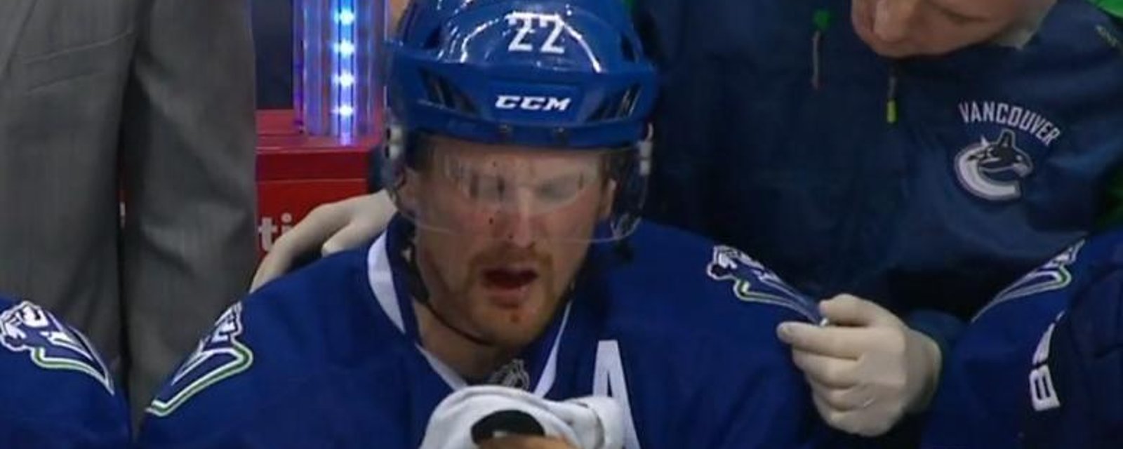 Fluke accident results in Daniel Sedin taking a puck to the mouth.