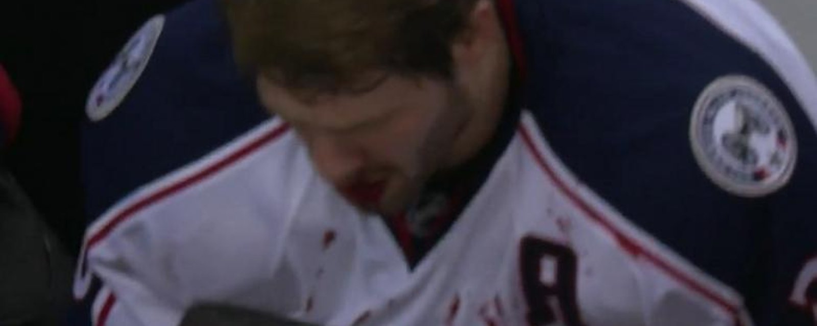 Jenner gets busted open and loses a few teeth in the process.