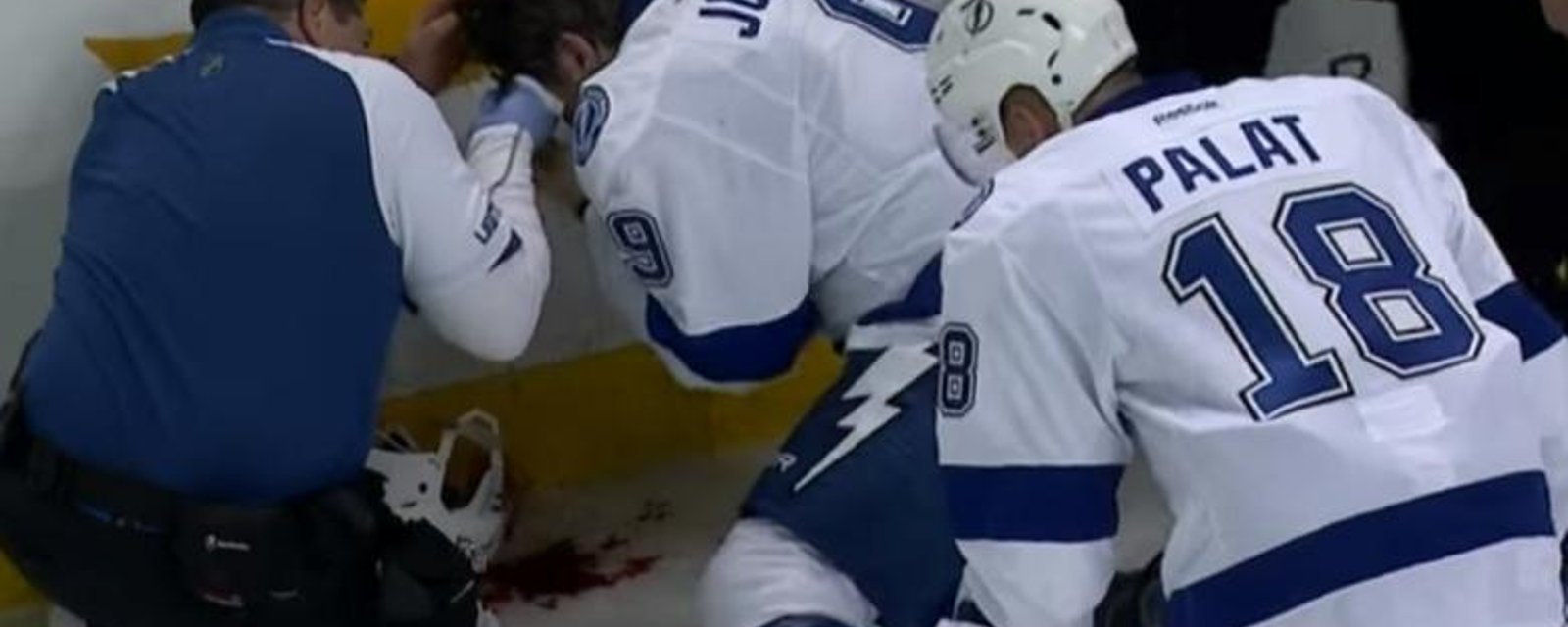 Tyler Johnson takes a shot to the face and is a bloody mess.