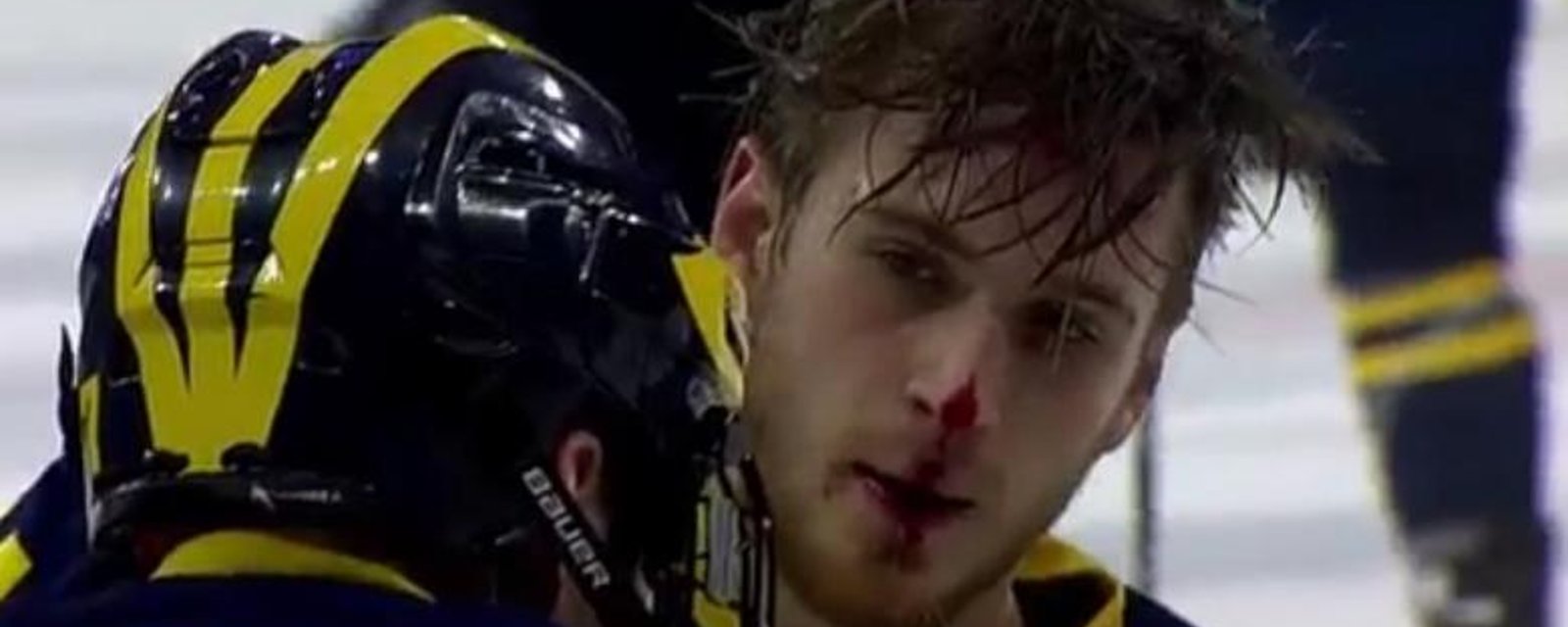 NHL prospect gets destroyed by one of the worst cheap shots you will ever see.