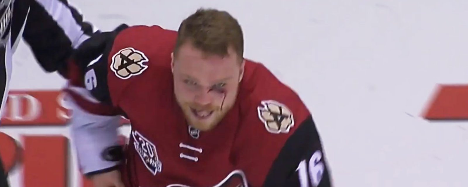 Must See: Max Domi's biggest fight leaves him with a bloody eye!