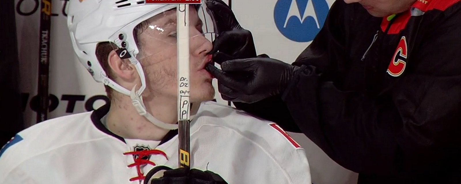 Tkachuk high-sticks himself in the face and a penalty is called!