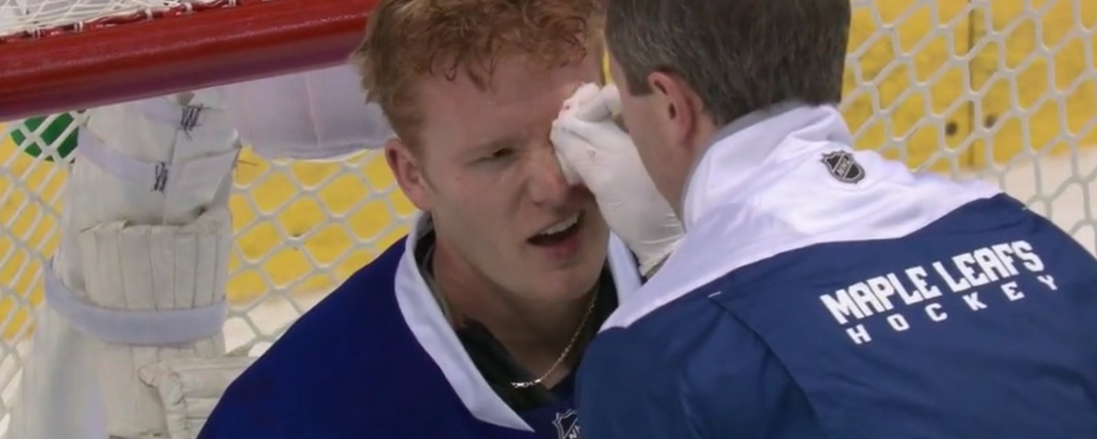 Leafs goalie Andersen split open by a high stick through his mask!