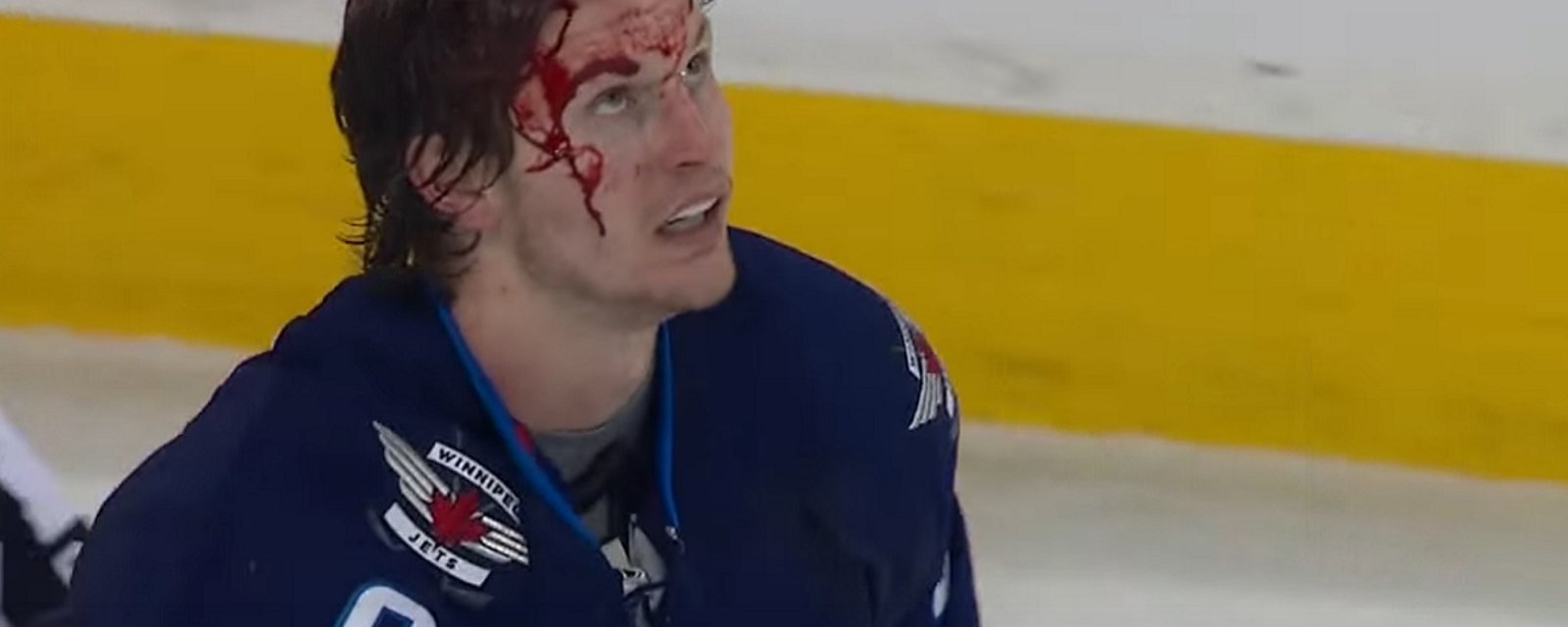 Breaking: Star defenseman out after one of the bloodiest fights of the season.