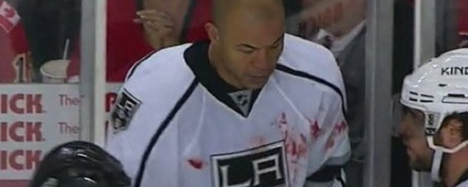Iginla wearing Engelland's blood on his jersey after great fight between two vets.