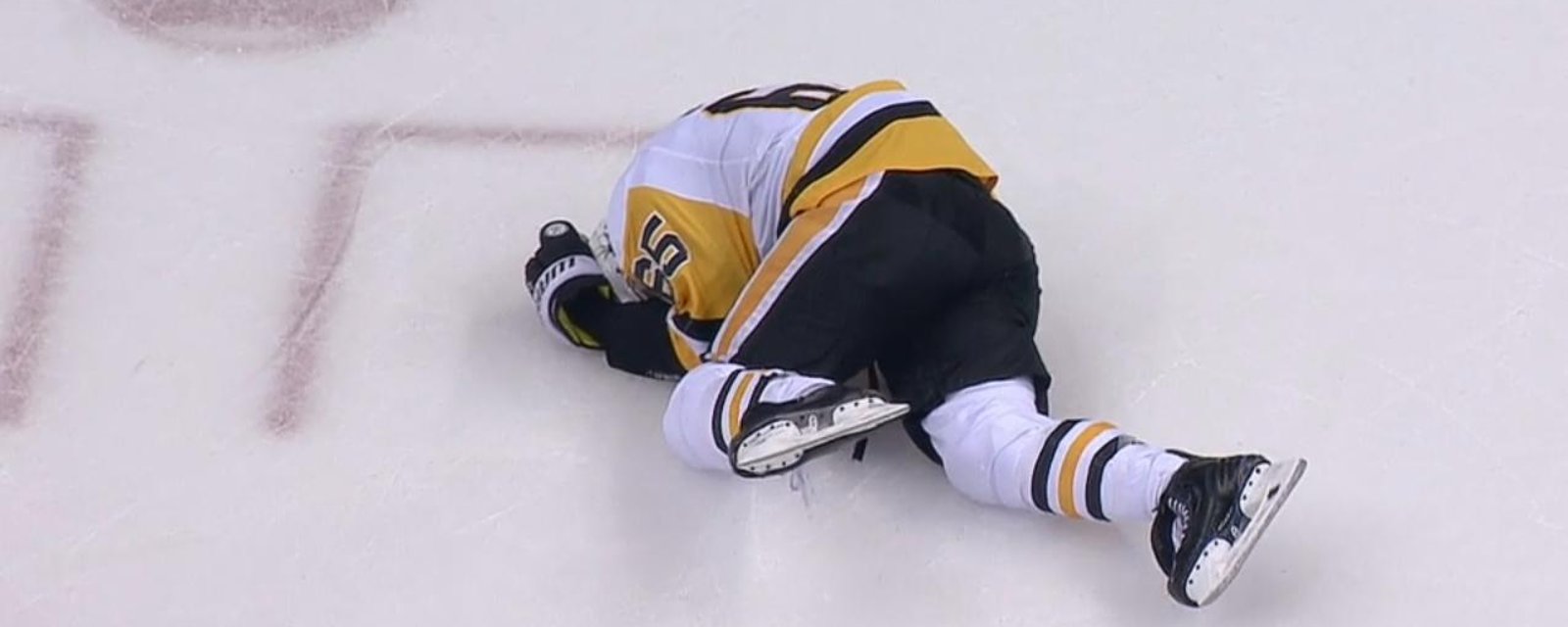 Hainsey possibly concussed after blocking Ovechkin's shot with his head. 