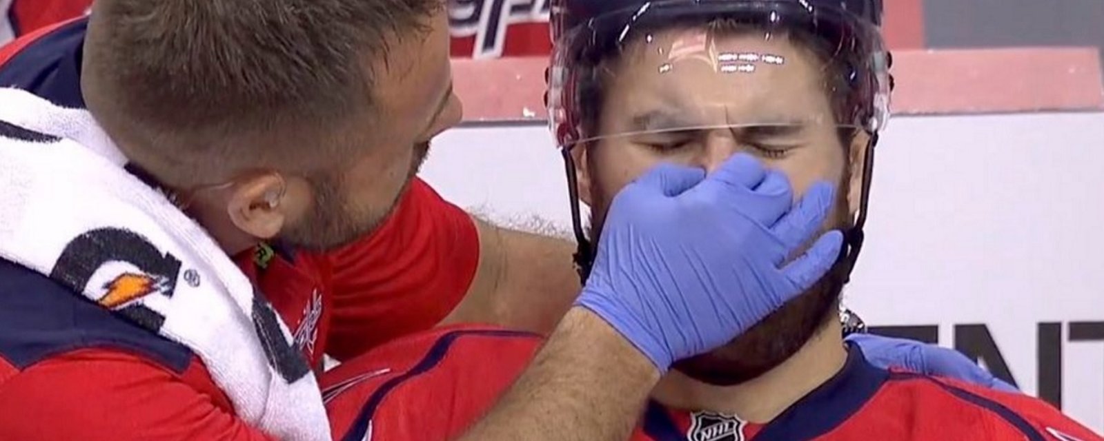 Trainer has to put player's nose back after a huge hit last night.