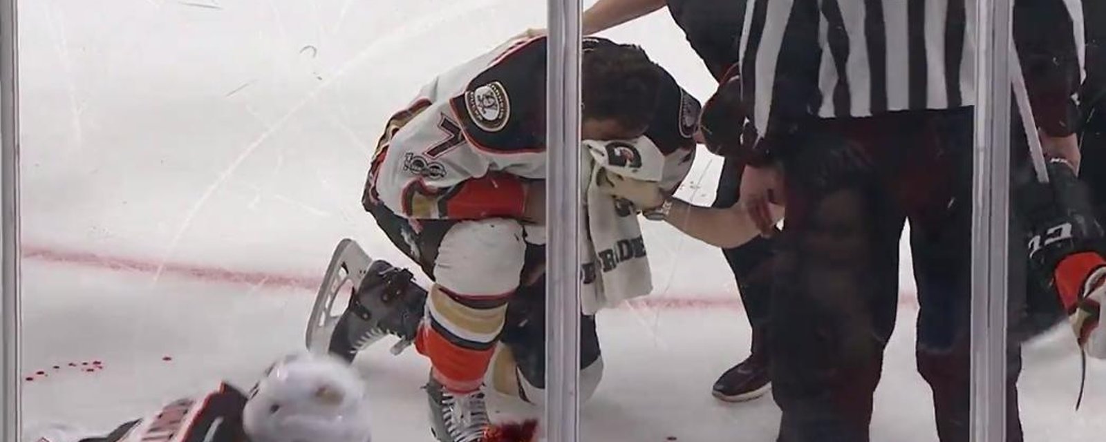 Cogliano bleeds all over the place after NASTY hit. 