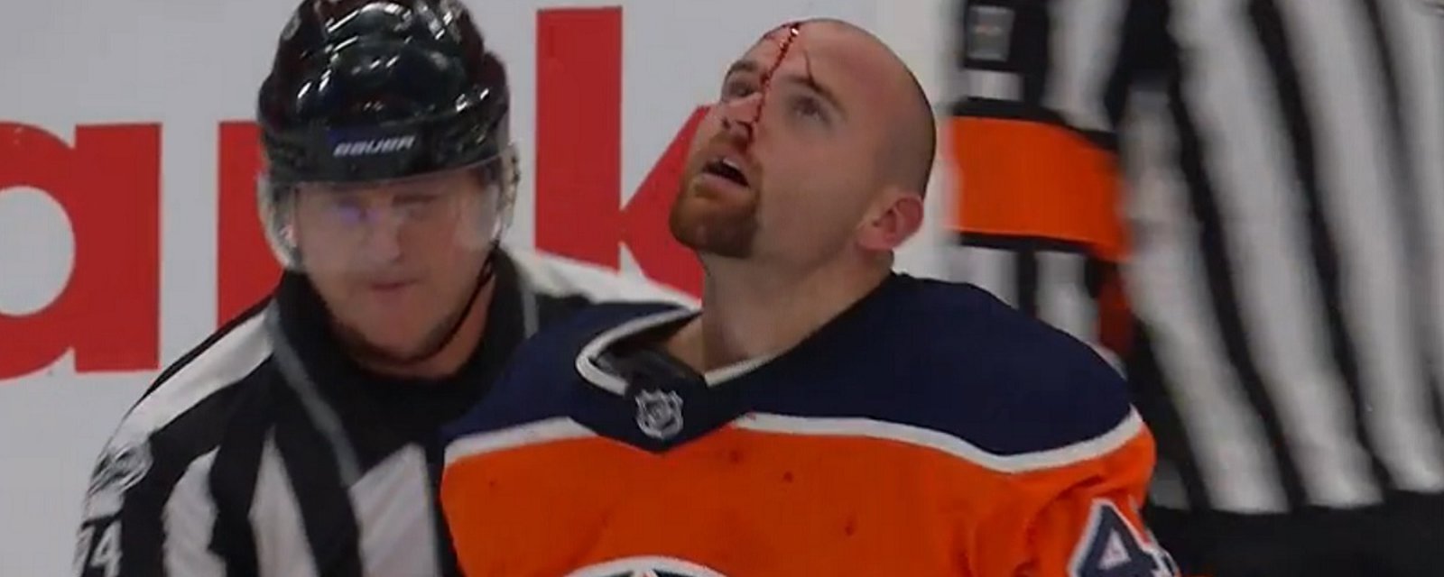 Early and bloody fight between Glass and Kassian. 