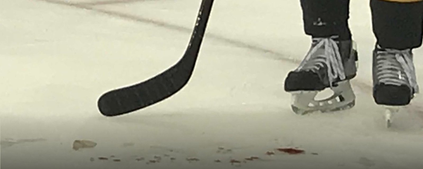 Must see: Gruesome injury leaves bloody mess on ice