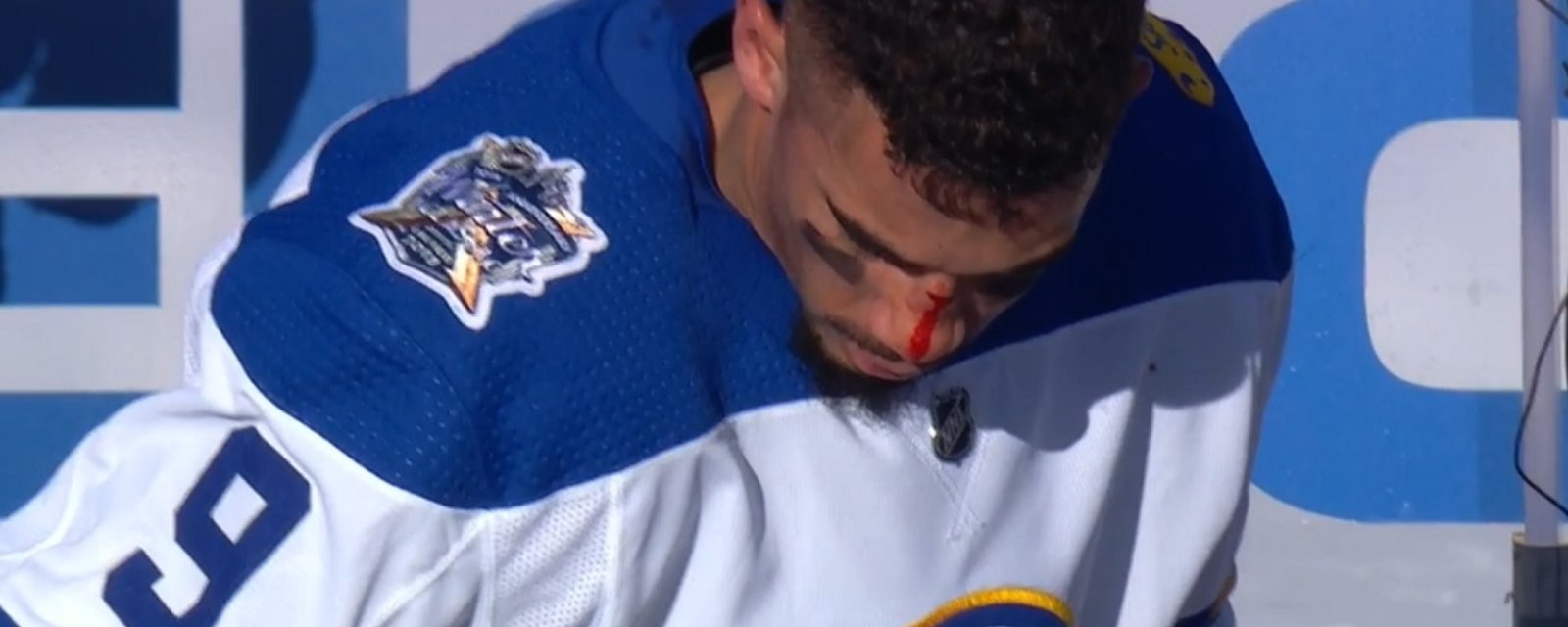 Kane eats a stick to the face, goes crashing head first into the boards.