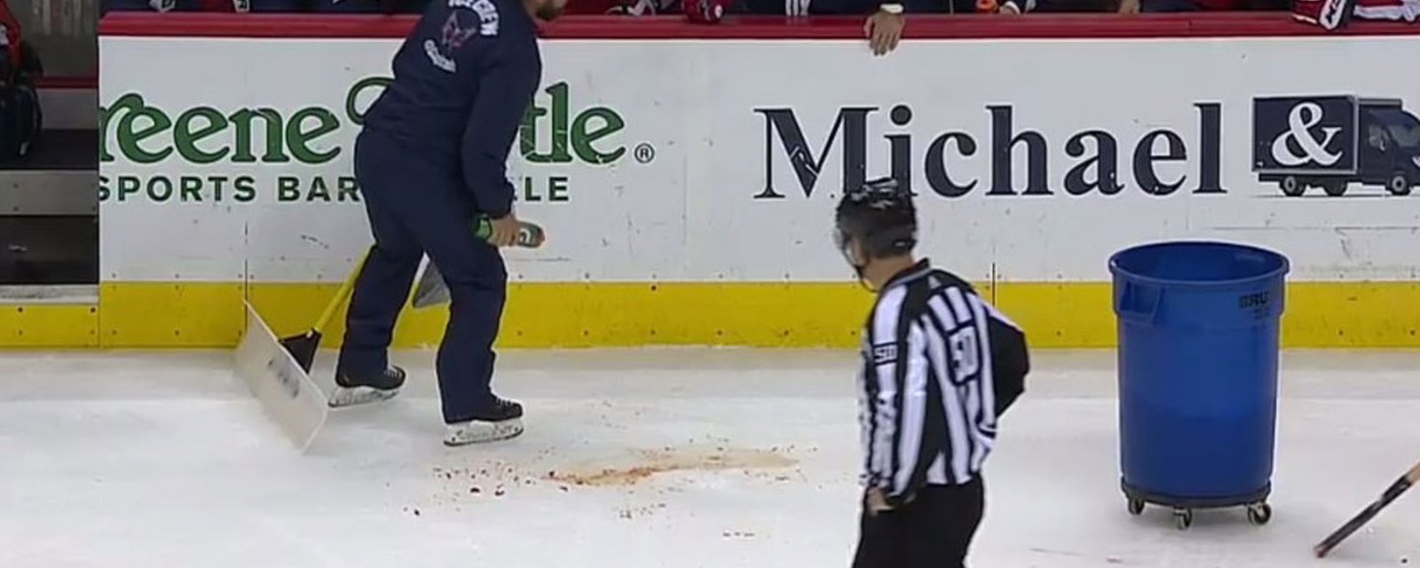 Breaking: Ovechkin leaves game a bloody mess! 